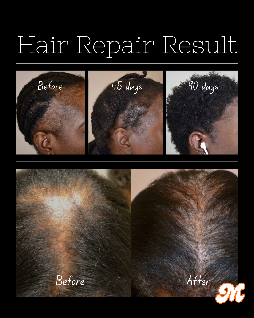 Menalated CrazyGrowth Hair Oil
