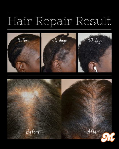 Menalated CrazyGrowth Hair Oil
